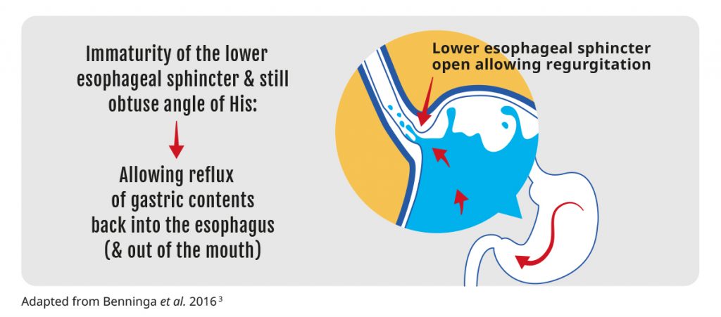 Reflux and regurgitation caused by early immaturity